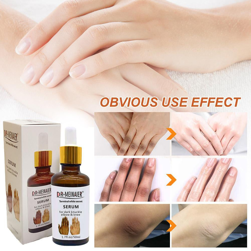 Sérum anti Quinto Dr. Meinaier pour Articulations Foncées