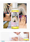 Huile de Peeling Extra forte pour l'élimination des quinto, des vergetures, des hyperpigmentations, et des cicatrices